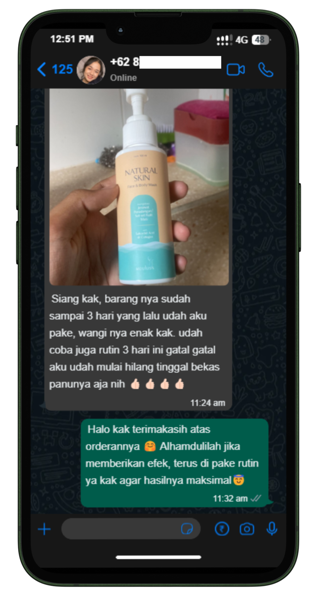 Testimoni WhatsApp pelanggan Mouluss — gatal reda dan bekas panu mulai hilang